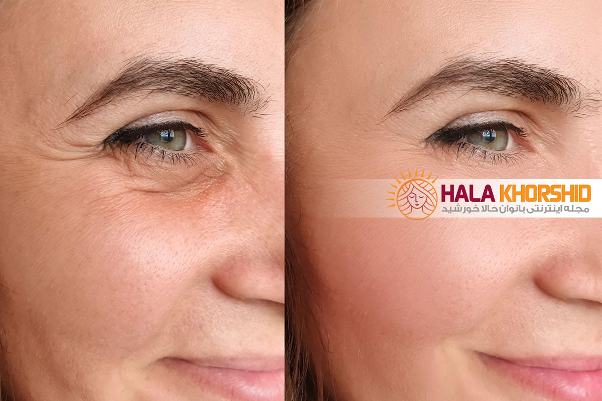 بهترین سرم های ضد چروک بازار ایران؛ راهنمای کامل انتخاب و خرید