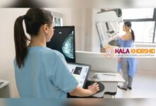 ماموگرافی برای زنان از چه سنی لازم است؟ بهترین سن شروع، فواصل انجام و پاسخ به دغدغه های رایج بانوان